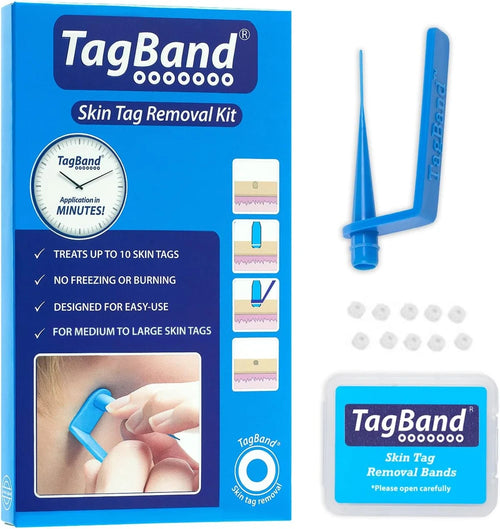 TagBand skin tag removal